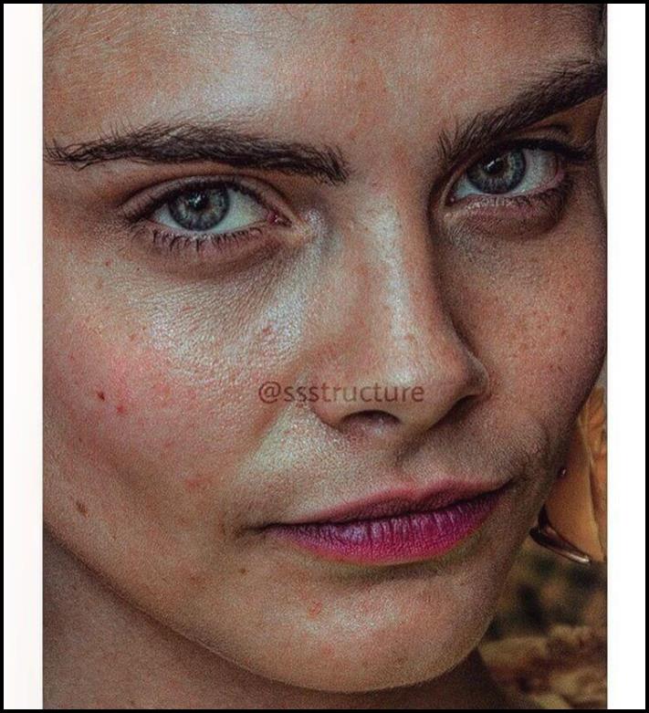 Բեղիկներ, ծակոտիներ և ցաներ: Ինչպիսին են համաշխարհային աստղերի դեմքերը մոտիկից