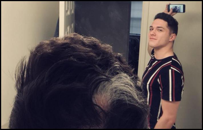 Մարդկանց անհավանական, բայց բավականին իրական մուտացիաներ. 16 լուսանկարների ընտրանի առանց Photoshop-ի