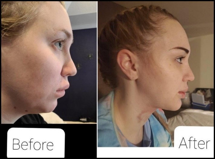 15 մարդ, ովքեր որոշեցին պլաստիկ վիրահատության ենթարկվել և այժմ միայն ափսոսում են, որ դա ավելի վաղ չեն արել