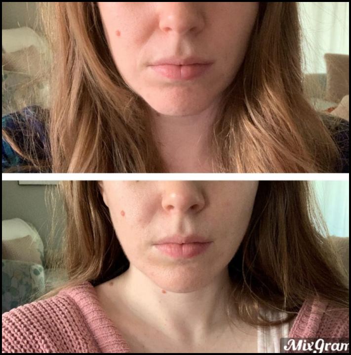 15 մարդ, ովքեր որոշեցին պլաստիկ վիրահատության ենթարկվել և այժմ միայն ափսոսում են, որ դա ավելի վաղ չեն արել