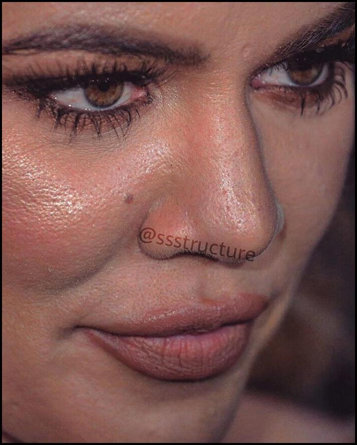 Բեղիկներ, ծակոտիներ և ցաներ: Ինչպիսին են համաշխարհային աստղերի դեմքերը մոտիկից