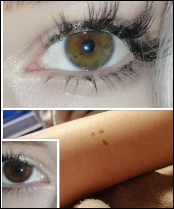 Մարդկանց անհավանական, բայց բավականին իրական մուտացիաներ. 16 լուսանկարների ընտրանի առանց Photoshop-ի