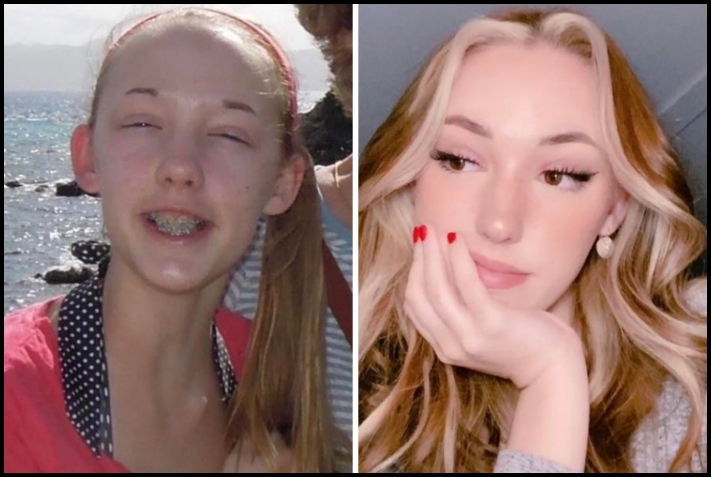 Մարդկանց 18 օրինակ, ովքեր կարծում էին, որ գեղեցիկ չեն, բայց դա կտրուկ փոխվեց տարիքի հետ