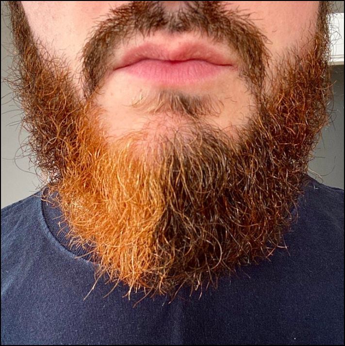 Մարդկանց 16 լուսանկար, որոնց մարմնի անսովոր հատկությունները նրանց տերերին առանձնացնում են մյուսներից