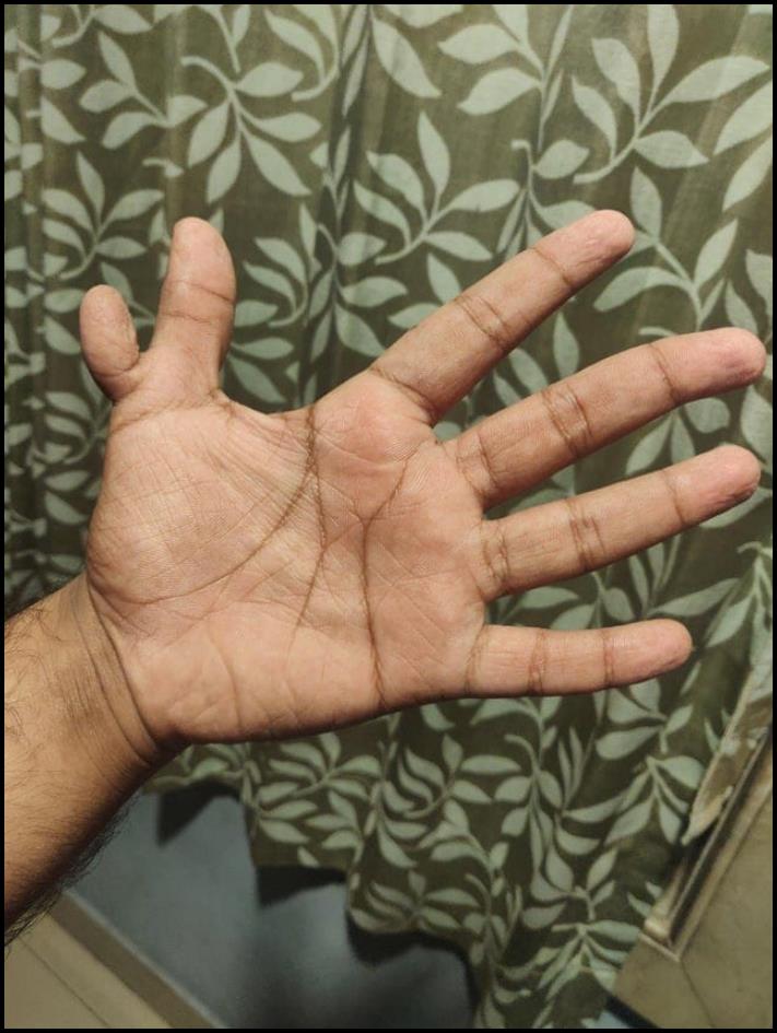 Մարդկանց անհավանական, բայց բավականին իրական մուտացիաներ. 16 լուսանկարների ընտրանի առանց Photoshop-ի