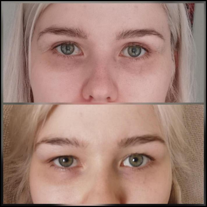 15 մարդ, ովքեր որոշեցին պլաստիկ վիրահատության ենթարկվել և այժմ միայն ափսոսում են, որ դա ավելի վաղ չեն արել