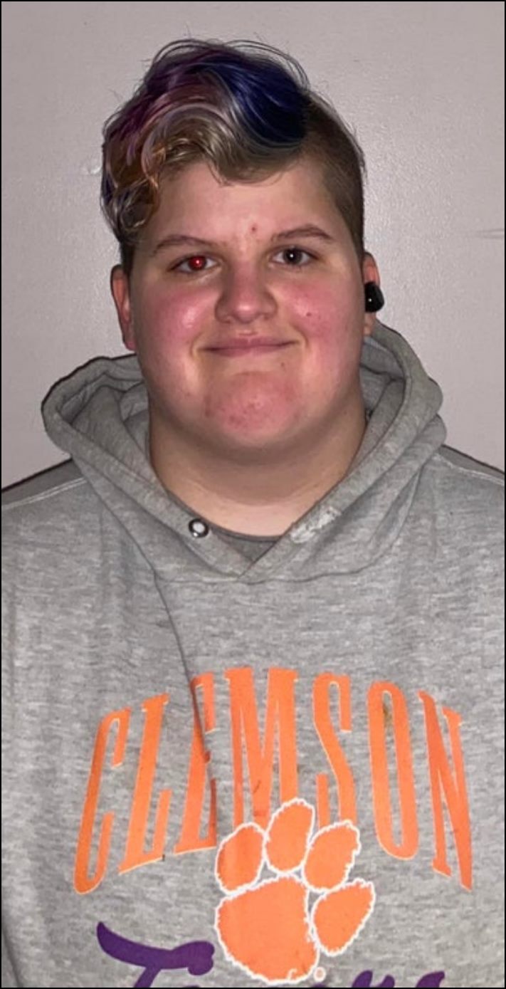 Մարդկանց 16 լուսանկար, որոնց մարմնի անսովոր հատկությունները նրանց տերերին առանձնացնում են մյուսներից