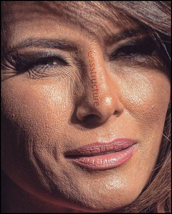 Բեղիկներ, ծակոտիներ և ցաներ: Ինչպիսին են համաշխարհային աստղերի դեմքերը մոտիկից