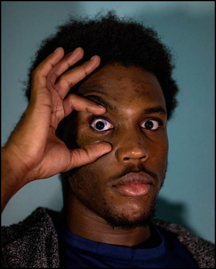 Մարդկանց անհավանական, բայց բավականին իրական մուտացիաներ. 16 լուսանկարների ընտրանի առանց Photoshop-ի