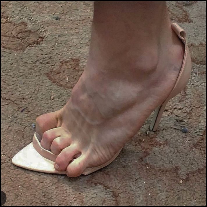 Ինչ ծայրահեղության են պատրաստ գնալ աղջիկները` կուրորեն հետևելով նորաձեւության միտումներին և ձգտելով կատարելության