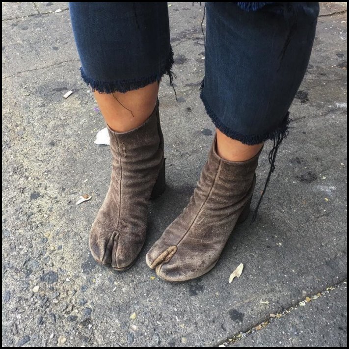 Ինչ ծայրահեղության են պատրաստ գնալ աղջիկները` կուրորեն հետևելով նորաձեւության միտումներին և ձգտելով կատարելության