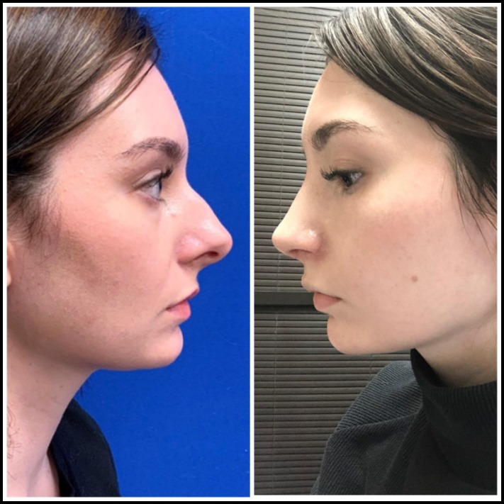 20 մարդ, ովքեր, հակառակ ամեն մի ինչի, ձեռնամուխ եղան պլաստիկ վիրահատությունների և ոչ մի անգամ չզղջացին դրա համար