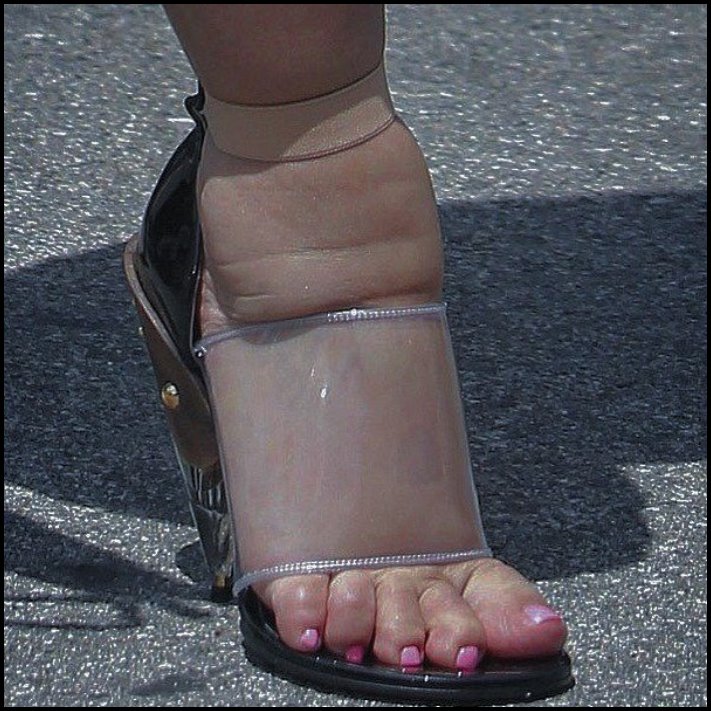 Ինչ ծայրահեղության են պատրաստ գնալ աղջիկները` կուրորեն հետևելով նորաձեւության միտումներին և ձգտելով կատարելության