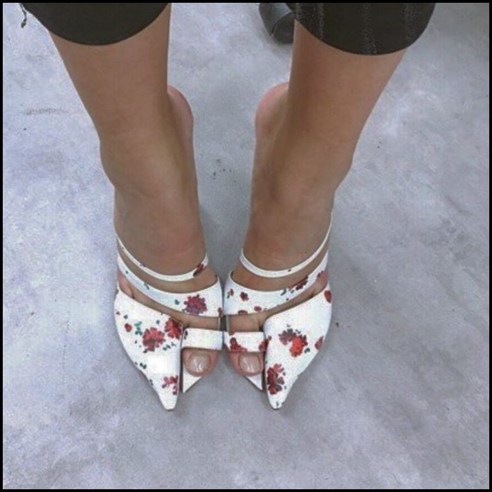 Ինչ ծայրահեղության են պատրաստ գնալ աղջիկները` կուրորեն հետևելով նորաձեւության միտումներին և ձգտելով կատարելության