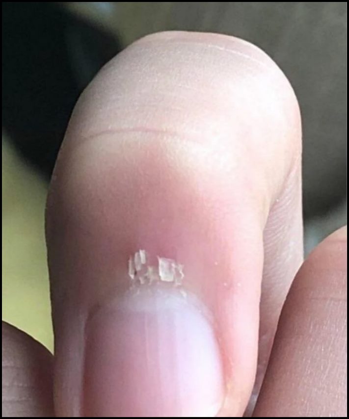 13 զվարճալի իրավիճակներ, որոնք նյարդայնացնում են նույնիսկ անբավարար ֆլեգմատիկ մարդկանց