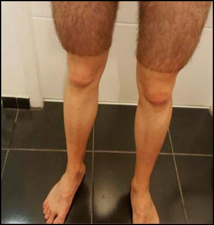 13 զվարճալի իրավիճակներ, որոնք նյարդայնացնում են նույնիսկ անբավարար ֆլեգմատիկ մարդկանց