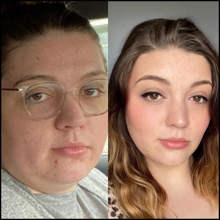 17 աղջիկ, ովքեր չեն վախենում ցույց տալ իրենց վատ նկարները, և այս անկատարությունը չի խանգարում նրանց գեղեցիկ լինել