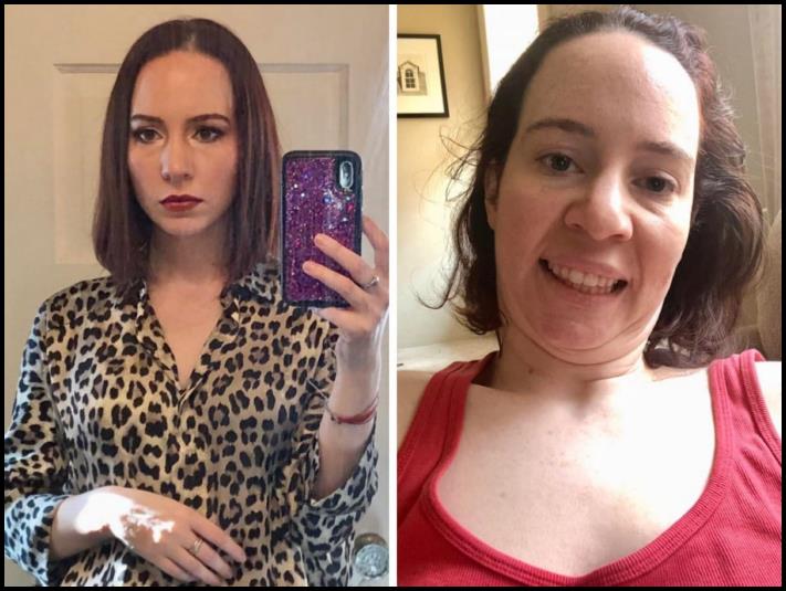 17 աղջիկ, ովքեր չեն վախենում ցույց տալ իրենց վատ նկարները, և այս անկատարությունը չի խանգարում նրանց գեղեցիկ լինել