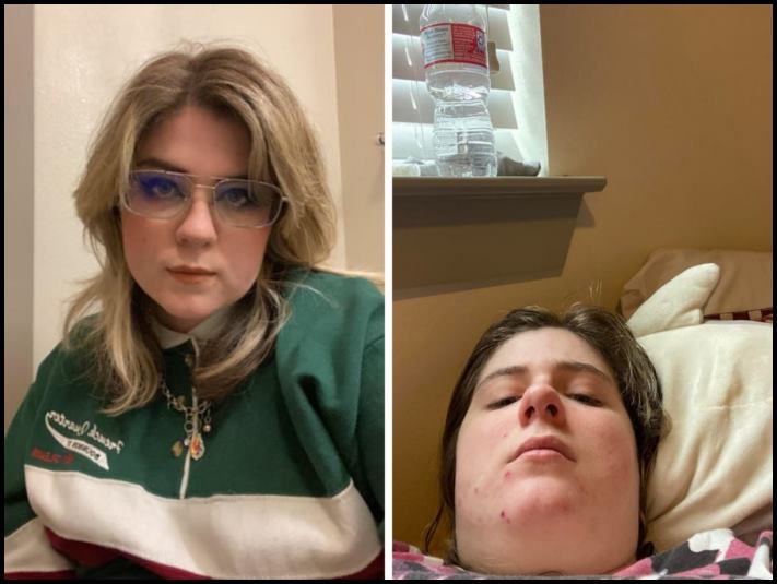 17 աղջիկ, ովքեր չեն վախենում ցույց տալ իրենց վատ նկարները, և այս անկատարությունը չի խանգարում նրանց գեղեցիկ լինել