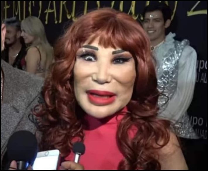 14 մարդ պլաստիկ վիրահատությունից հետո, որոնց ավելի լավ է չնայել