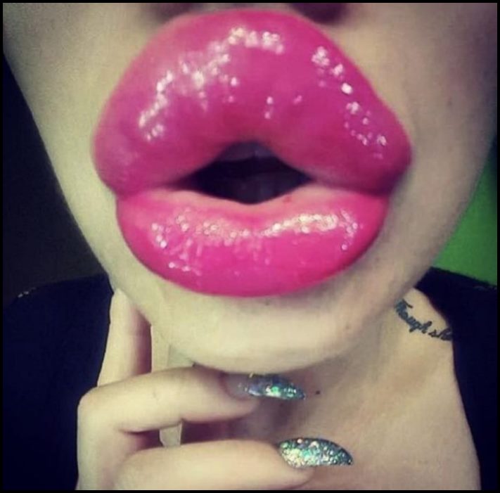 14 մարդ պլաստիկ վիրահատությունից հետո, որոնց ավելի լավ է չնայել