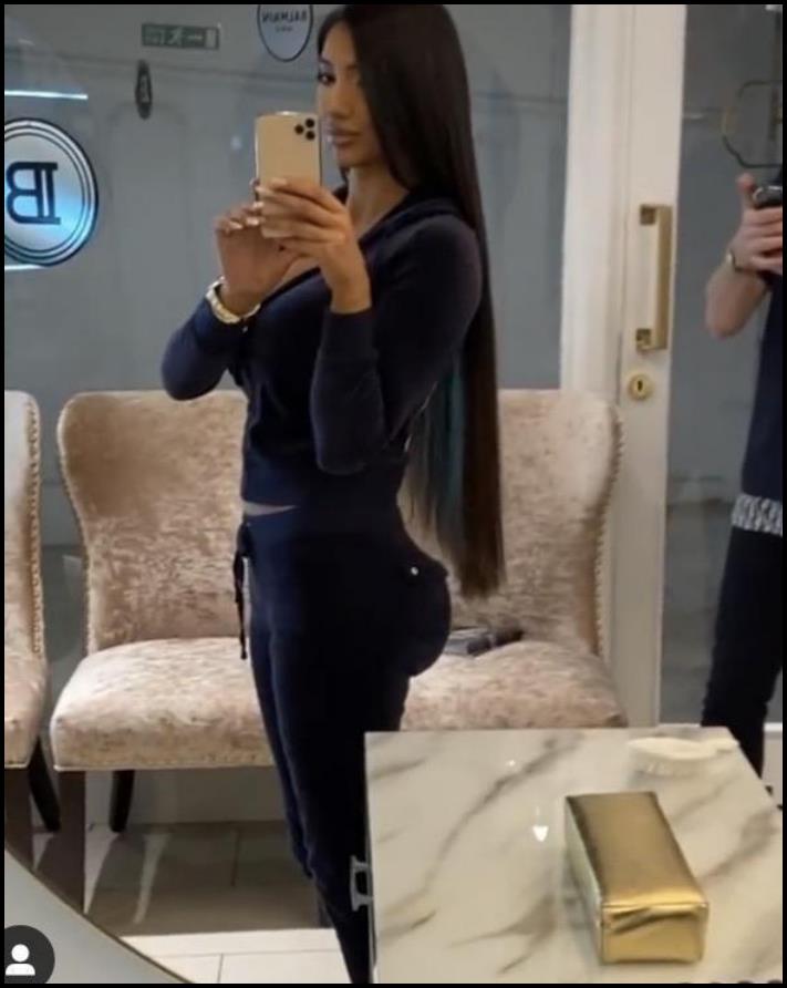 14 մարդ պլաստիկ վիրահատությունից հետո, որոնց ավելի լավ է չնայել