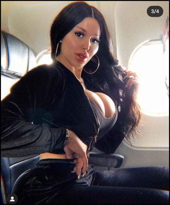 14 մարդ պլաստիկ վիրահատությունից հետո, որոնց ավելի լավ է չնայել