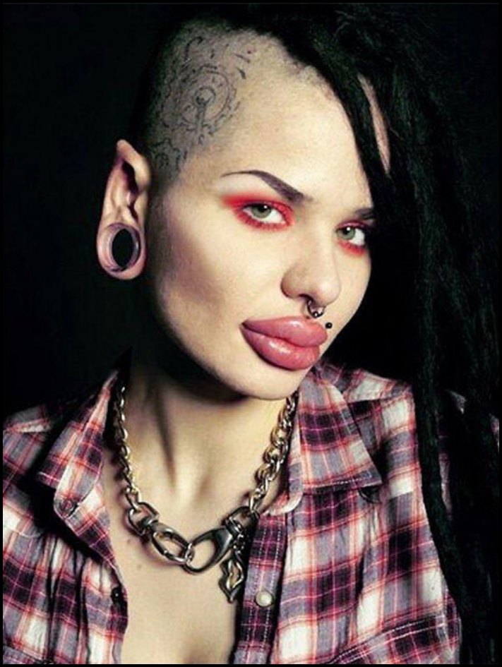 Դեմքի կեսը փչել են: 10 աղջիկ, ովքեր չափը շատ անցան՝ շրթունքների մեծացման հարցում