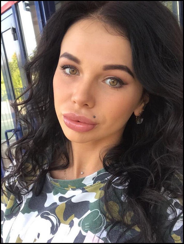 Դեմքի կեսը փչել են: 10 աղջիկ, ովքեր չափը շատ անցան՝ շրթունքների մեծացման հարցում