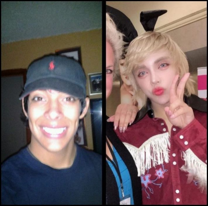 14 մարդ պլաստիկ վիրահատությունից հետո, որոնց ավելի լավ է չնայել