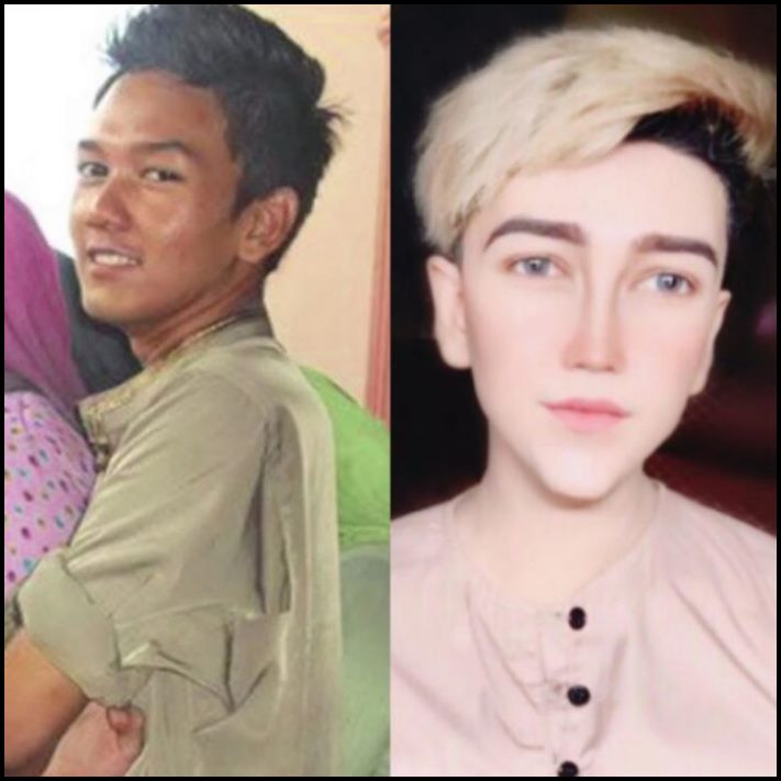 14 մարդ պլաստիկ վիրահատությունից հետո, որոնց ավելի լավ է չնայել