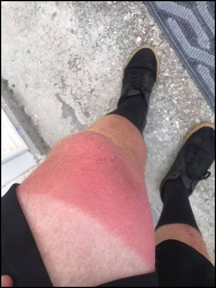 19 ապացույց այն բանի, որ միշտ էլ կա մի բան, ինչն է՛լ &laquo;ավելի վատ&raquo; է, և երբ էլ ոչինչ չի զարմացնում ձեզ