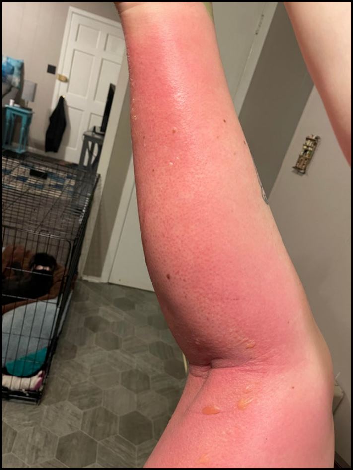 19 ապացույց այն բանի, որ միշտ էլ կա մի բան, ինչն է՛լ &laquo;ավելի վատ&raquo; է, և երբ էլ ոչինչ չի զարմացնում ձեզ