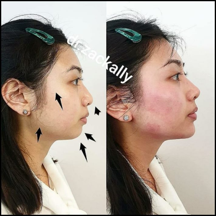 Ինչու է պլաստիկ վիրաբուժությունը Աստծո նվեր։ Լուսանկարներ, որոնք փոփոխության են ներշնչում