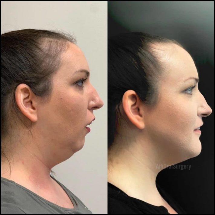 Ինչու է պլաստիկ վիրաբուժությունը Աստծո նվեր։ Լուսանկարներ, որոնք փոփոխության են ներշնչում