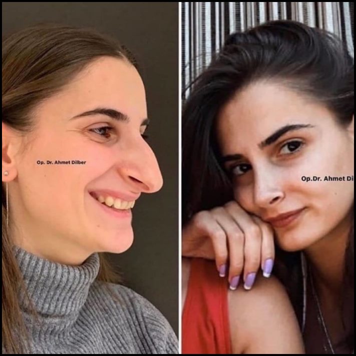 Ինչու է պլաստիկ վիրաբուժությունը Աստծո նվեր։ Լուսանկարներ, որոնք փոփոխության են ներշնչում