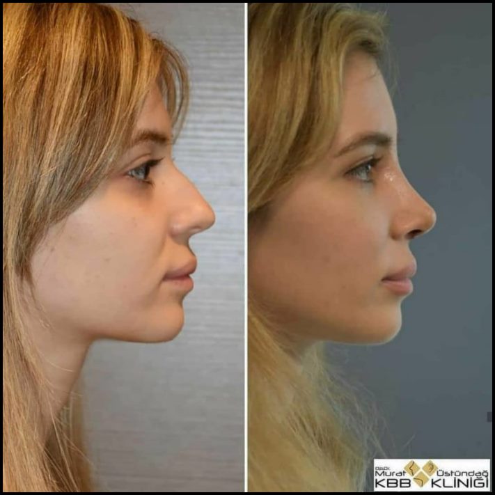 Ինչու է պլաստիկ վիրաբուժությունը Աստծո նվեր։ Լուսանկարներ, որոնք փոփոխության են ներշնչում