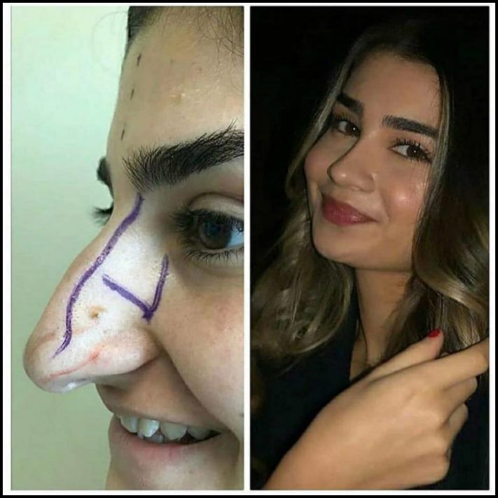 Ինչու է պլաստիկ վիրաբուժությունը Աստծո նվեր։ Լուսանկարներ, որոնք փոփոխության են ներշնչում