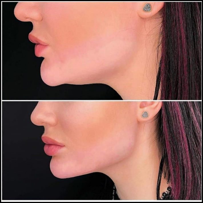 Ինչու է պլաստիկ վիրաբուժությունը Աստծո նվեր։ Լուսանկարներ, որոնք փոփոխության են ներշնչում