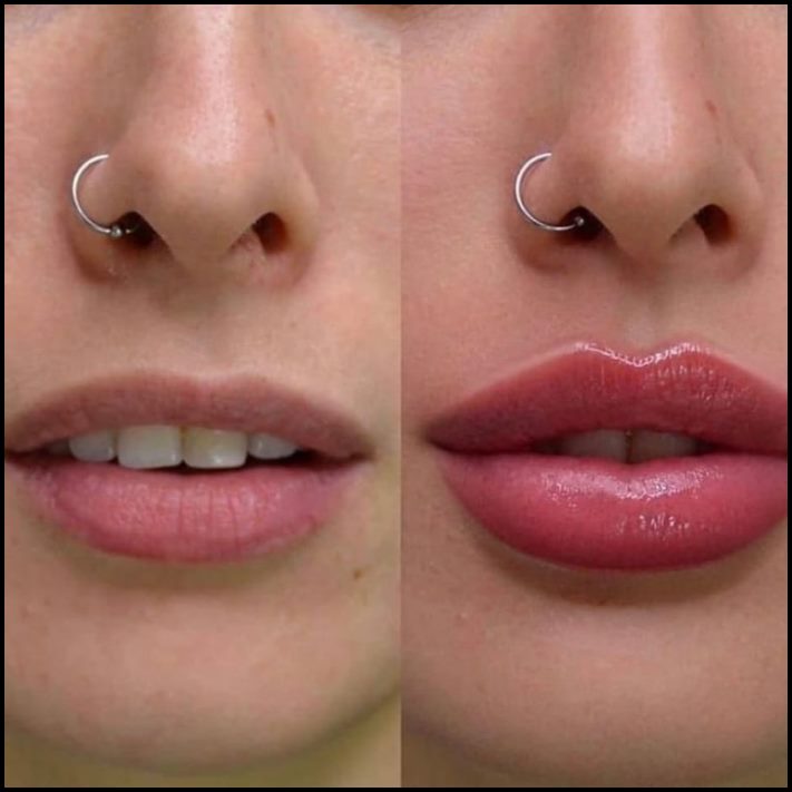 Ինչու է պլաստիկ վիրաբուժությունը Աստծո նվեր։ Լուսանկարներ, որոնք փոփոխության են ներշնչում