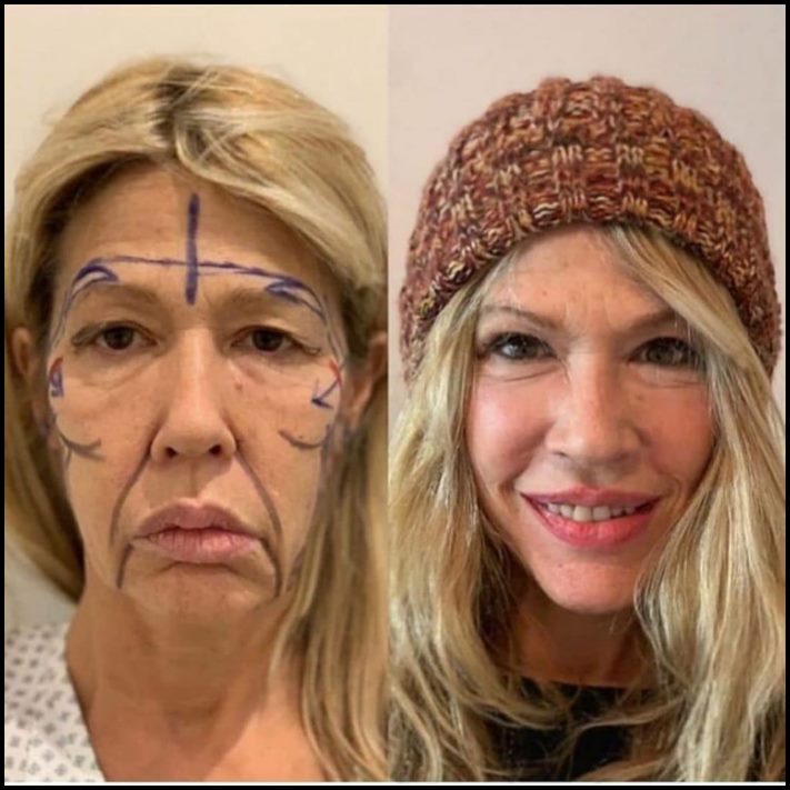 Ինչու է պլաստիկ վիրաբուժությունը Աստծո նվեր։ Լուսանկարներ, որոնք փոփոխության են ներշնչում