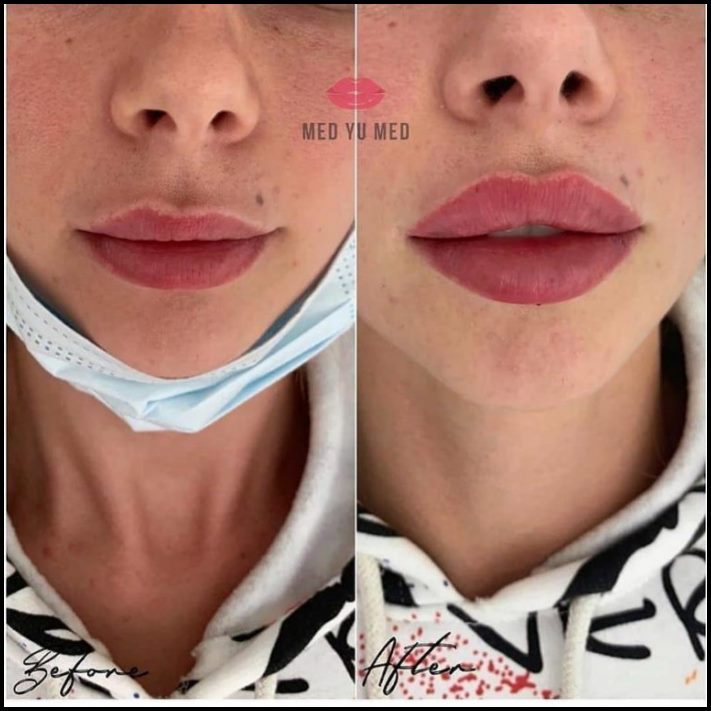 Ինչու է պլաստիկ վիրաբուժությունը Աստծո նվեր։ Լուսանկարներ, որոնք փոփոխության են ներշնչում