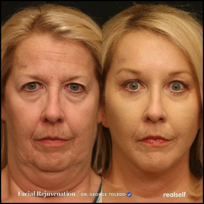 Ինչու է պլաստիկ վիրաբուժությունը Աստծո նվեր։ Լուսանկարներ, որոնք փոփոխության են ներշնչում