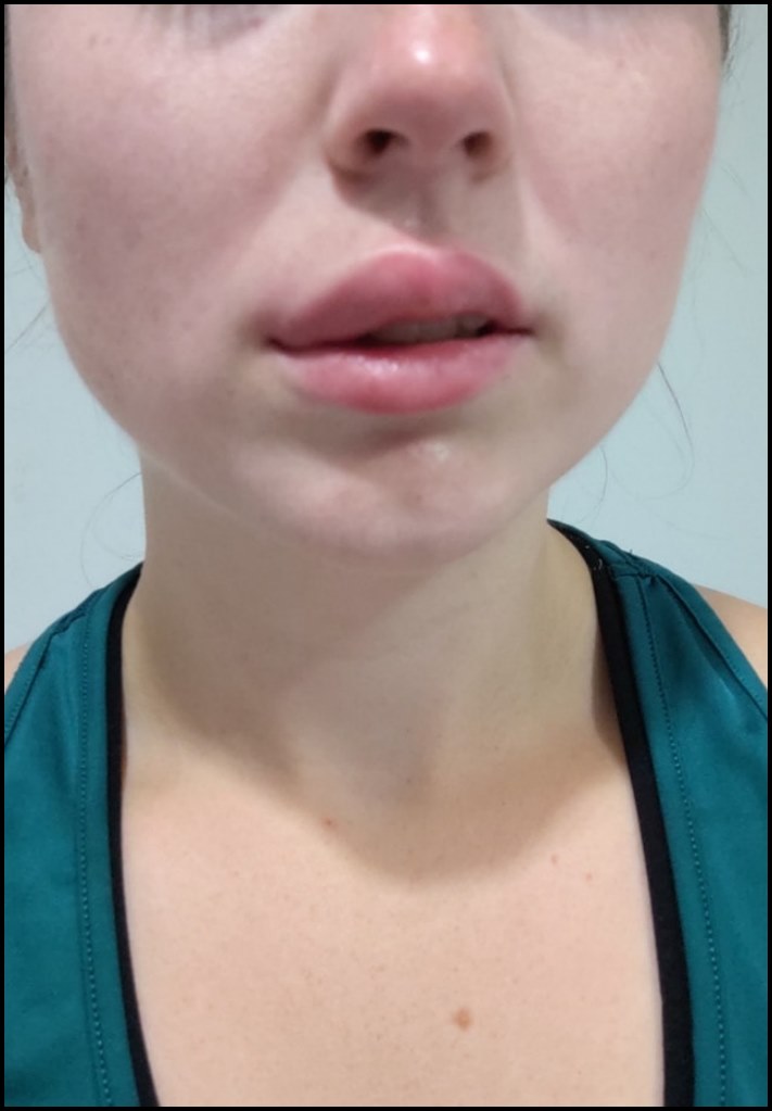 16 օրինակներ, երբ կյանքը մարդկանց վրա անսպասելի տհաճ անակնկալներ է նետել