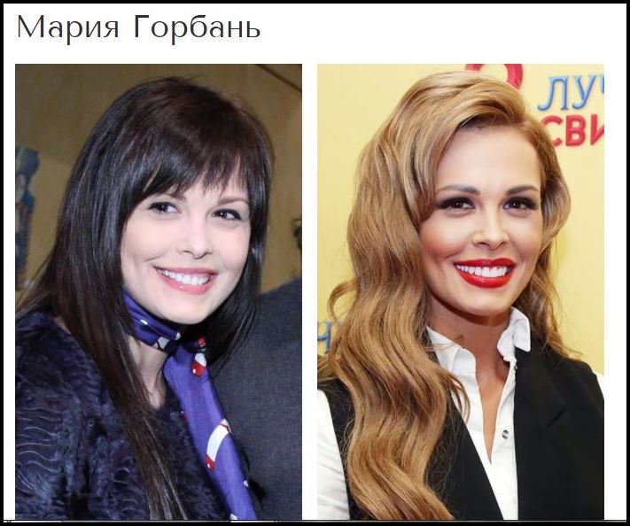 Շնորհակալությո՛ւն, բժիշկ: Պլաստիկ վիրահատություններից հետո հաջողության հասած 8 աստղեր