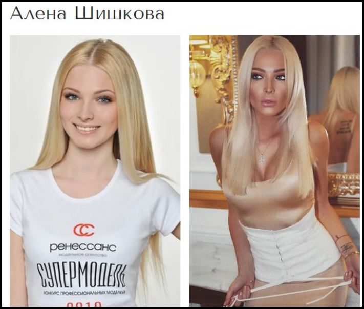 Շնորհակալությո՛ւն, բժիշկ: Պլաստիկ վիրահատություններից հետո հաջողության հասած 8 աստղեր