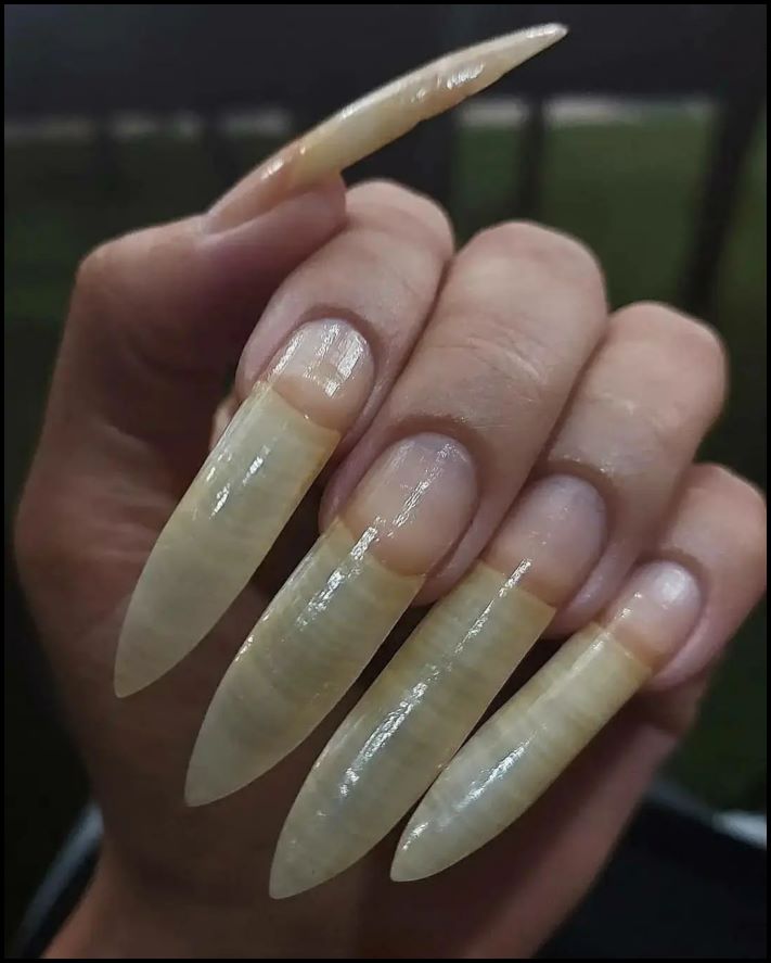 Այսպես մի արեք։ Եղունգների 10 օրինակ, որոնց նայելը նույնիսկ տհաճ է