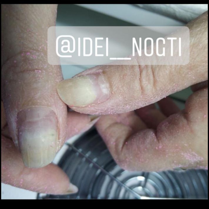 Այսպես մի արեք։ Եղունգների 10 օրինակ, որոնց նայելը նույնիսկ տհաճ է