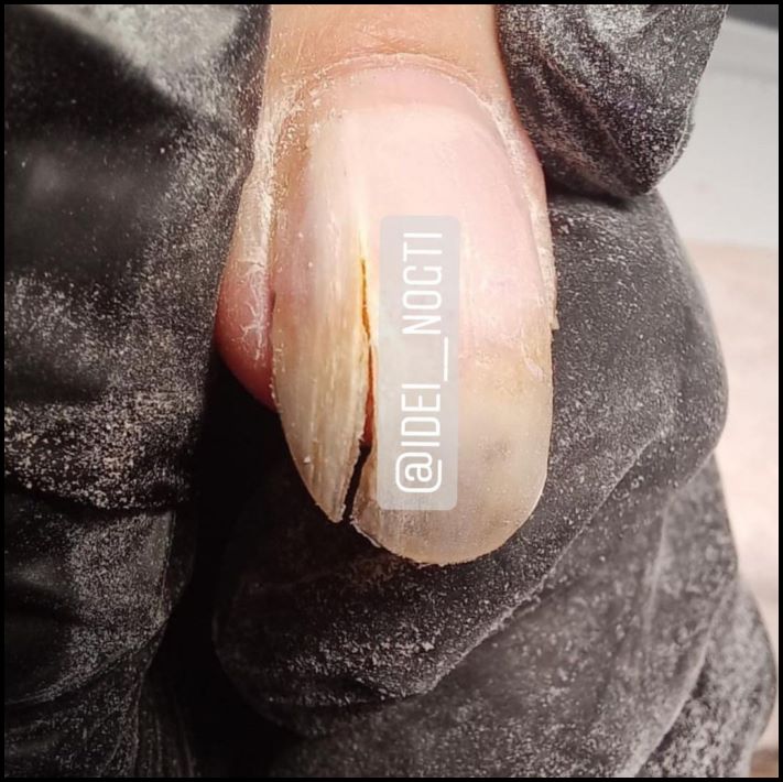 Այսպես մի արեք։ Եղունգների 10 օրինակ, որոնց նայելը նույնիսկ տհաճ է