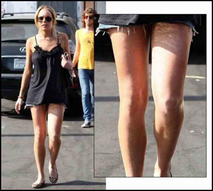 Այսպես էլ կլինի: Աստղային գեղեցկուհիների լուսանկարներ, ովքեր հանդես են գալիս հանուն բնականության